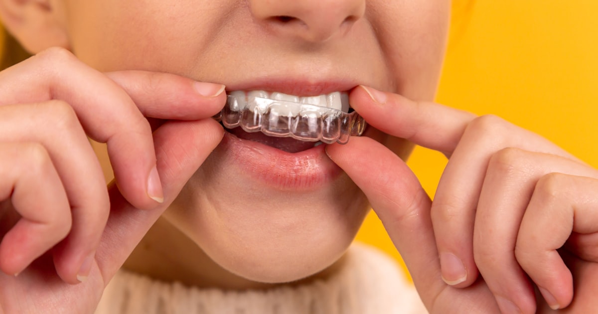 Flúor na Odontologia: Benefícios, Riscos e a Verdade Científica