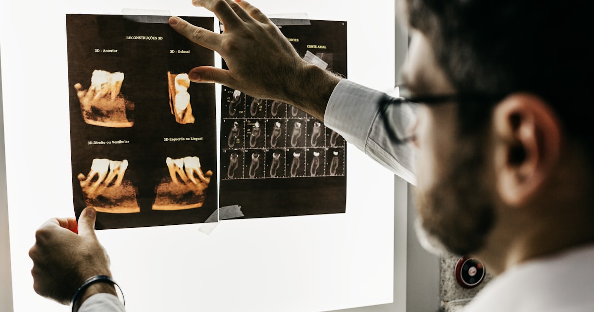 Resina vs. Porcelana: Qual Restauração Dental É Melhor?